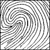 5,双斗纹(composite whorl)